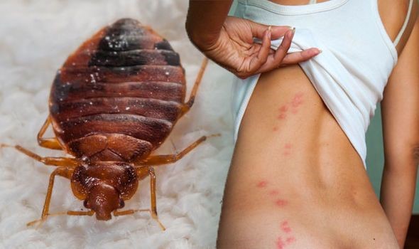 O Que Atrai Percevejo: Fatores Que Aumentam a Presença Dessas Pragas em Sua Casa